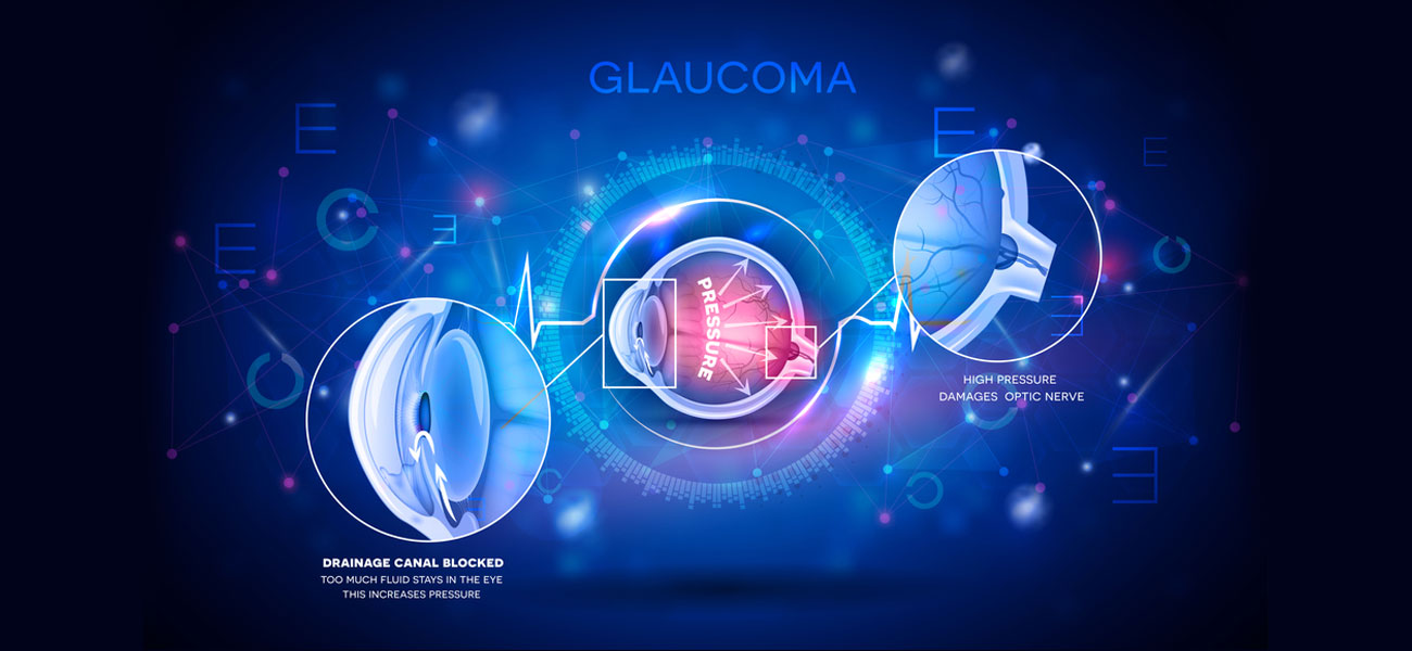 Superspecliality Eye Clinic